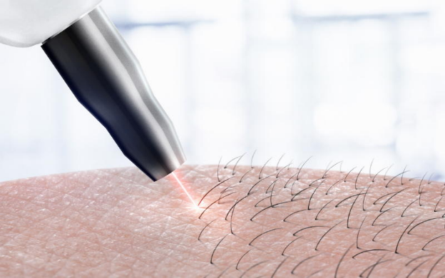 بهترین مرکز لیزر موهای زائد در اهواز