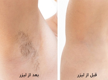 زیر بغل