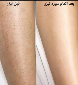ساق پا