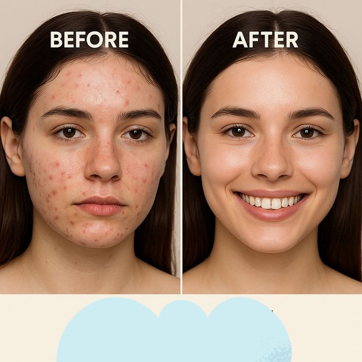 بهترین مرکز پاکسازی پوست در پیروزی