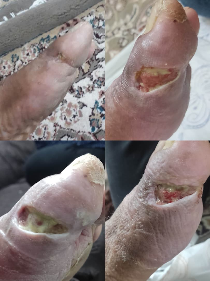 کلینیک زخم در اصفهان