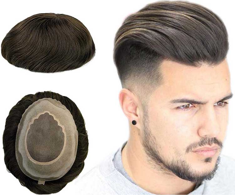 پروتز مو مردانه فولاد شهر