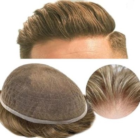 پروتز مو فولادشهر