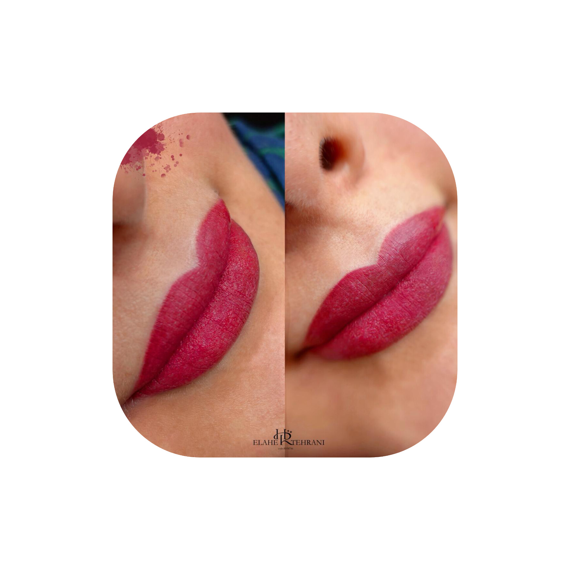 مرکز زیبایی یزد 