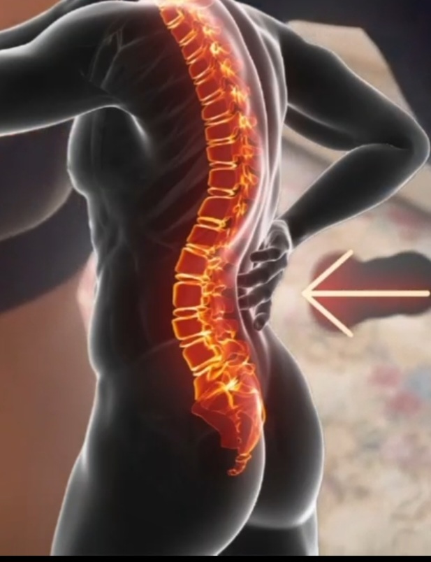 دیسک وسیاتیک بدون عمل