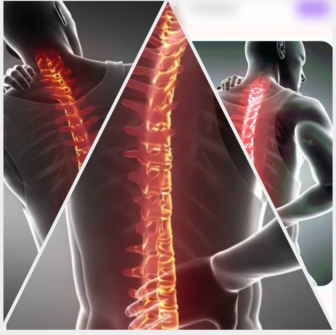 دیسک وسیاتیک بدون عمل