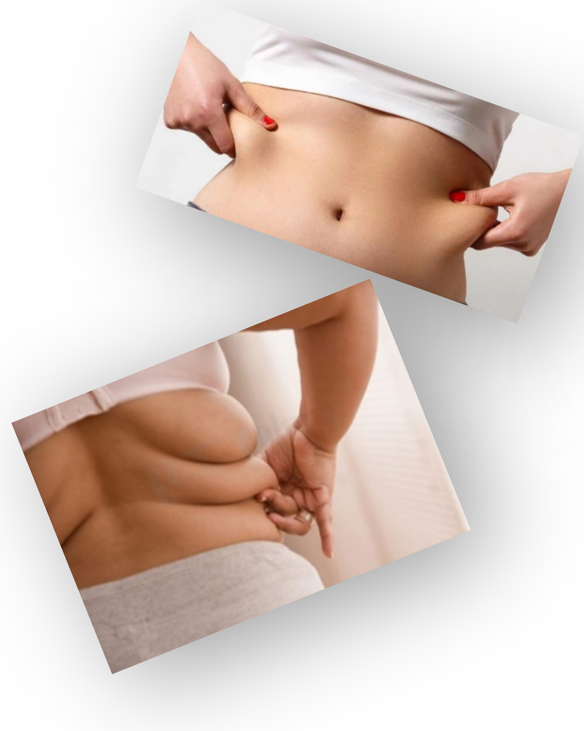 لیپوساکشن در زاهدان