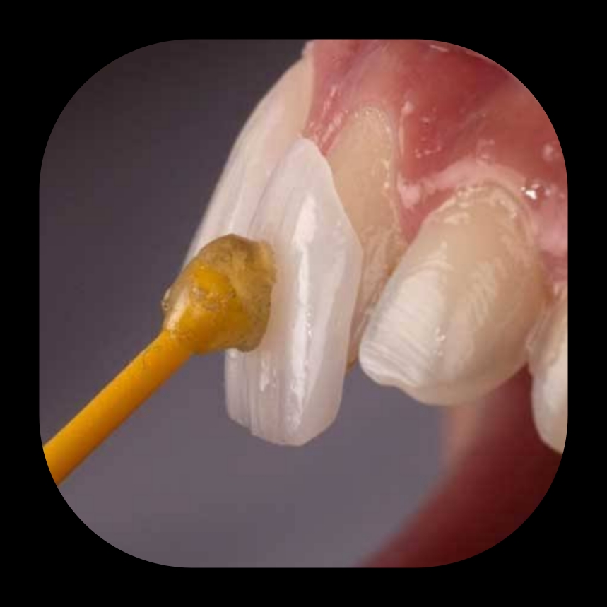 بهترین دندانپزشک زیبایی در شیراز