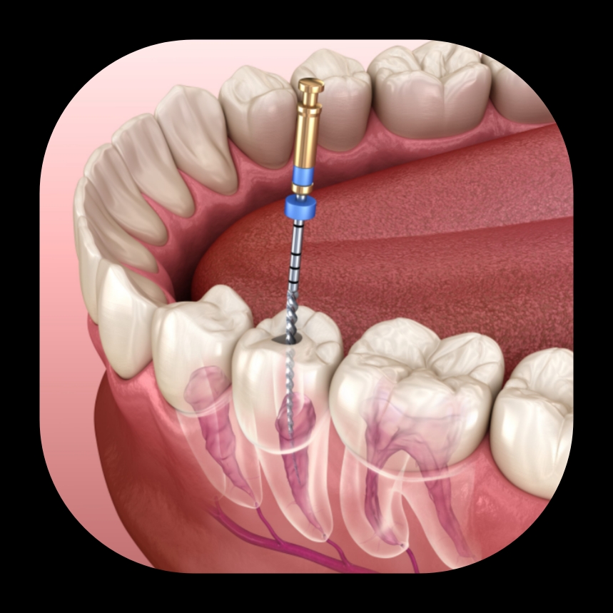 بهترین دندانپزشک زیبایی در شیراز