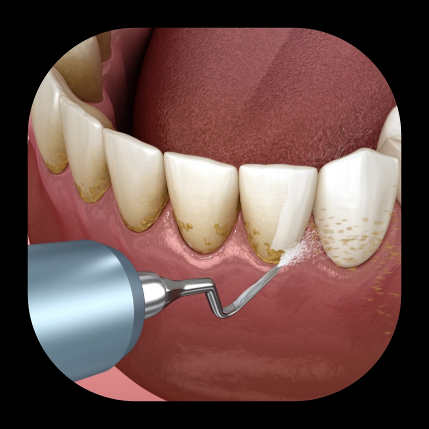 بهترین دندانپزشک زیبایی در شیراز