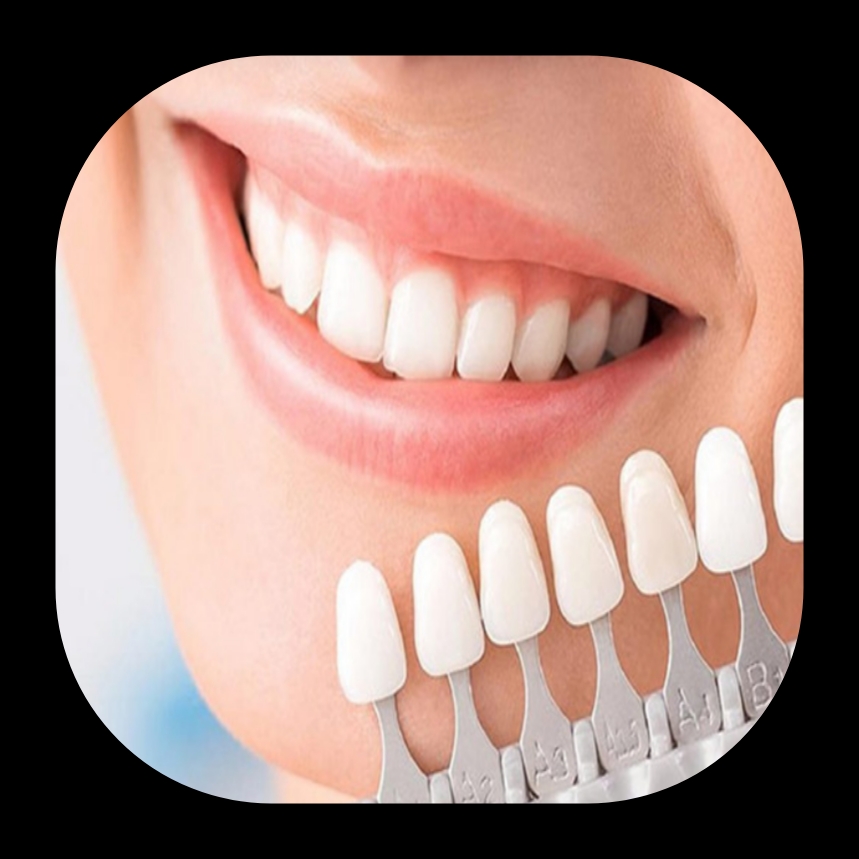 بهترین دندانپزشک زیبایی در شیراز