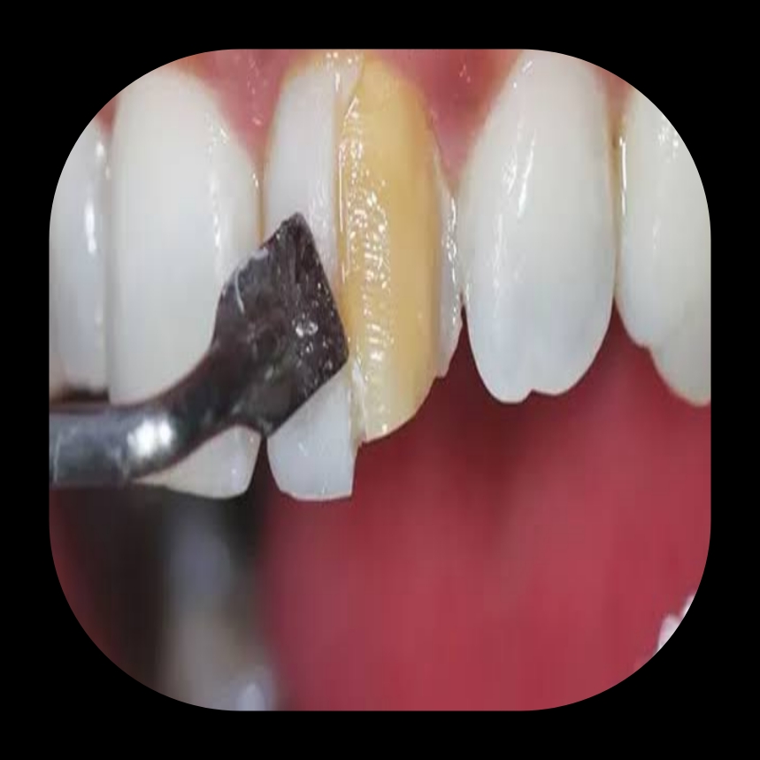 بهترین دندانپزشک زیبایی در شیراز