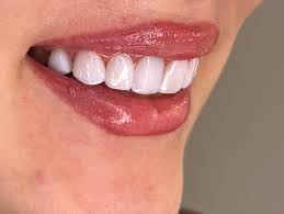 بهترین دندانپزشک زیبایی در شیراز