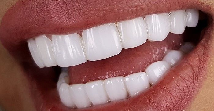 بهترین دندانپزشک زیبایی در شیراز