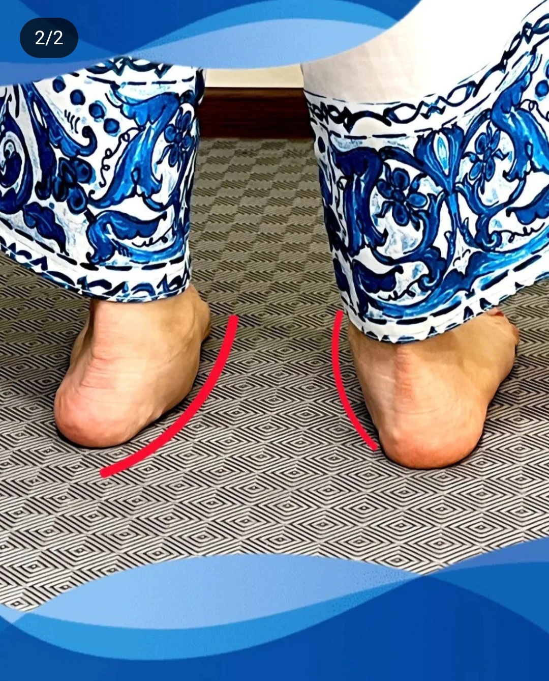 اسکن کف پا در شهرک غرب