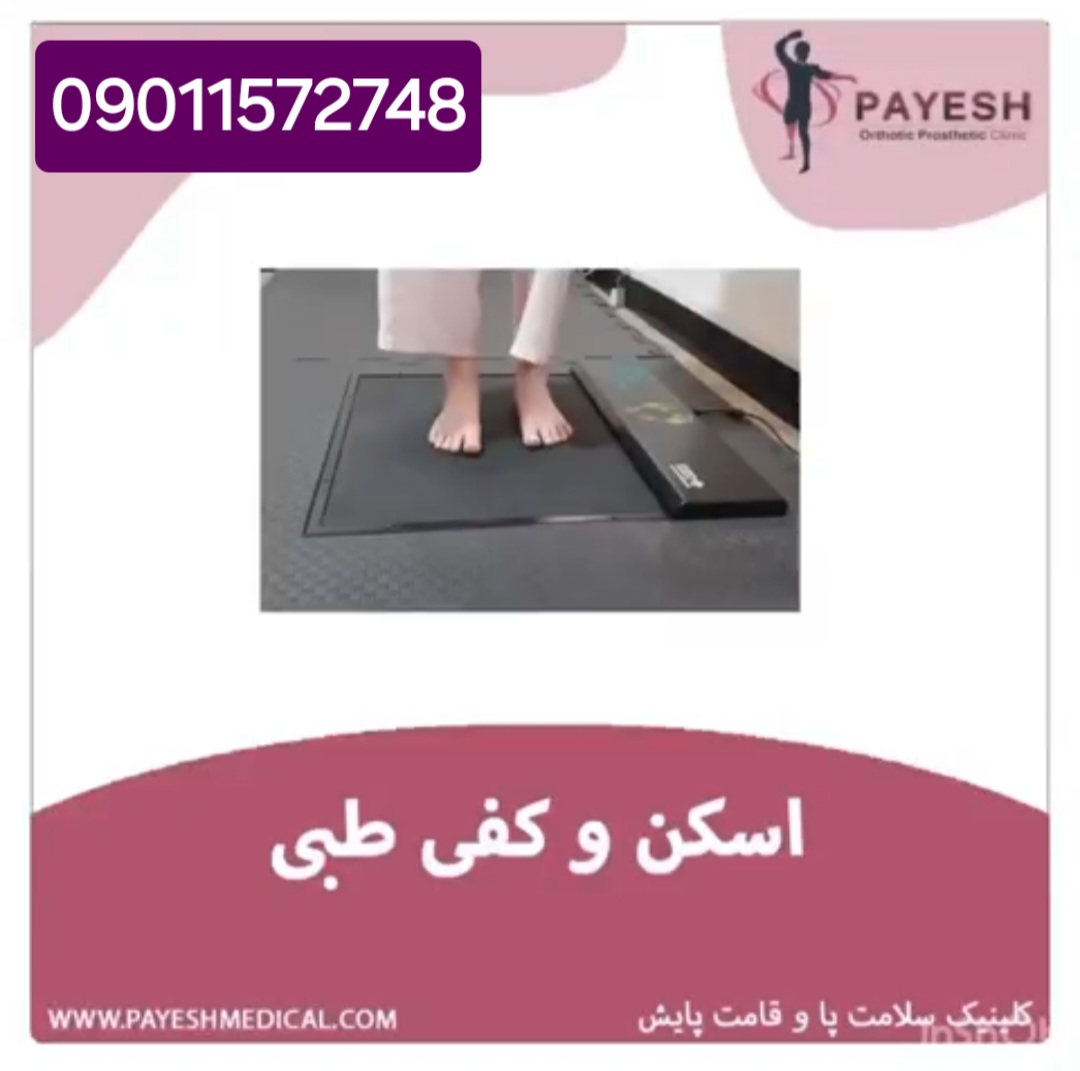 اسکن کف پا در شهرک غرب