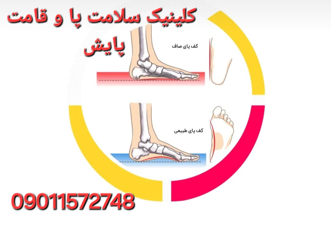 اسکن کف پا در شهرک غرب