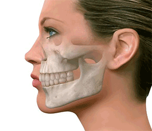 زاویه فک اصفهان