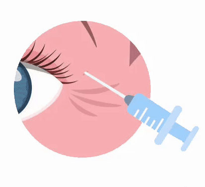 فیلر در اصفهان