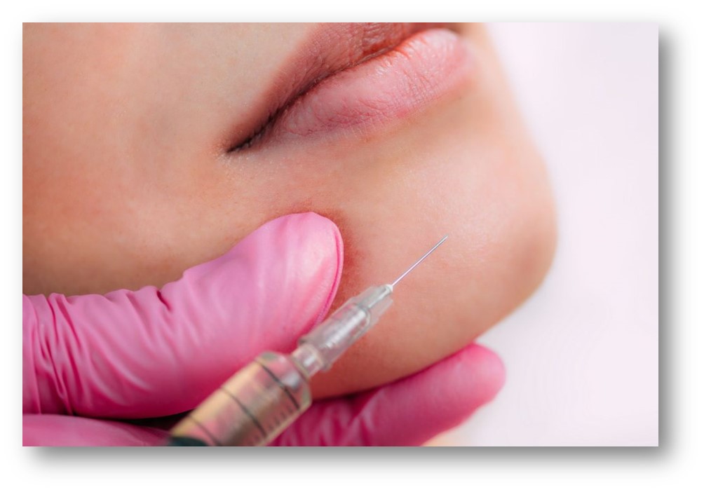 فیلر چانه نچرال