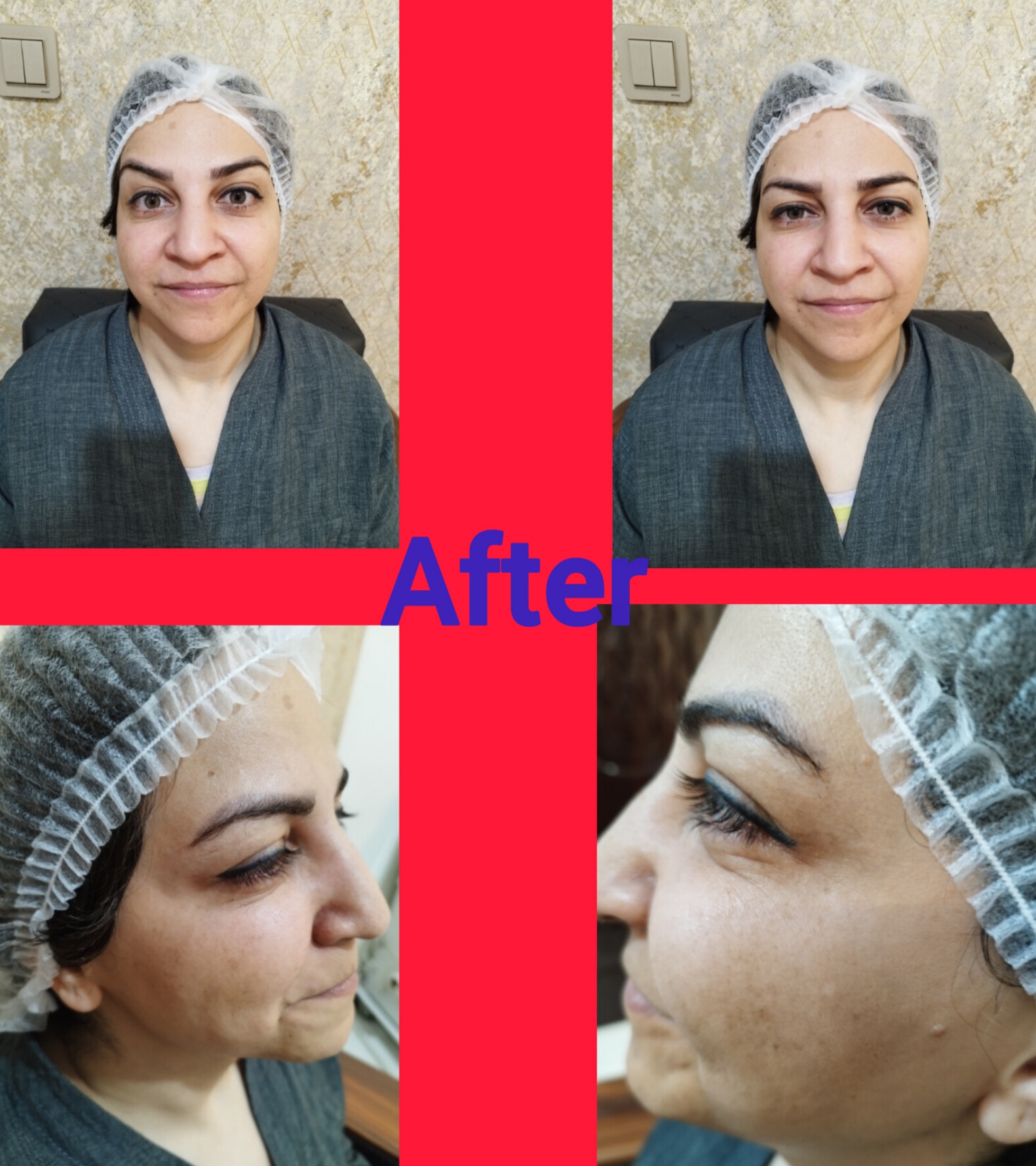 بهترین دکتر پوست و زیبایی کرمان