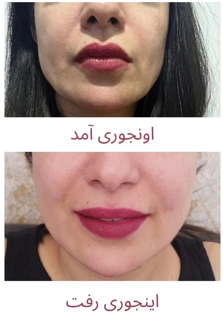 بهترین دکتر پوست و زیبایی کرمان