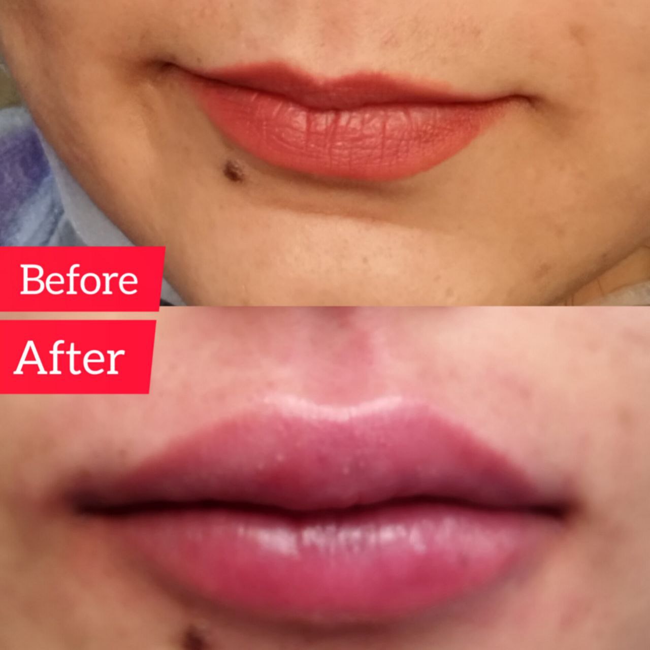 بهترین دکتر پوست و زیبایی کرمان