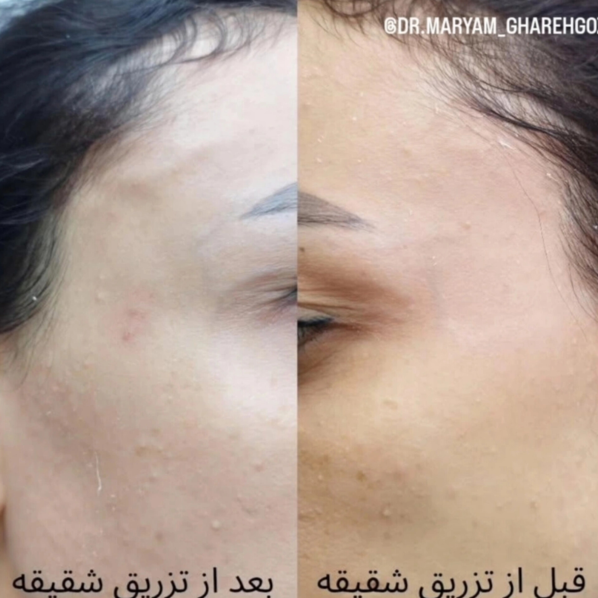 بهترین دکتر پوست و زیبایی کرمان