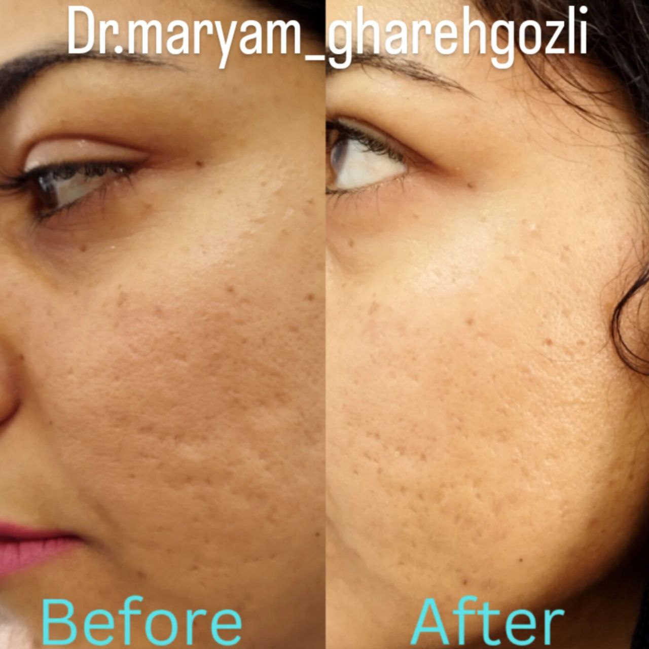 بهترین دکتر پوست و زیبایی کرمان