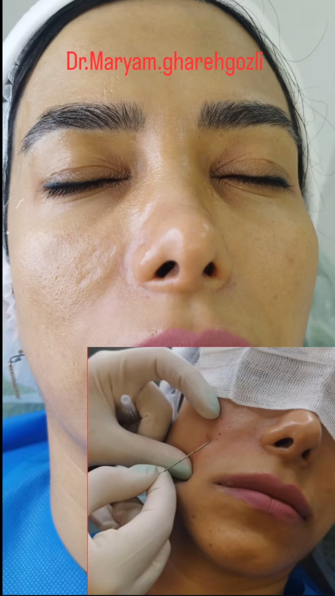 بهترین دکتر پوست و زیبایی کرمان