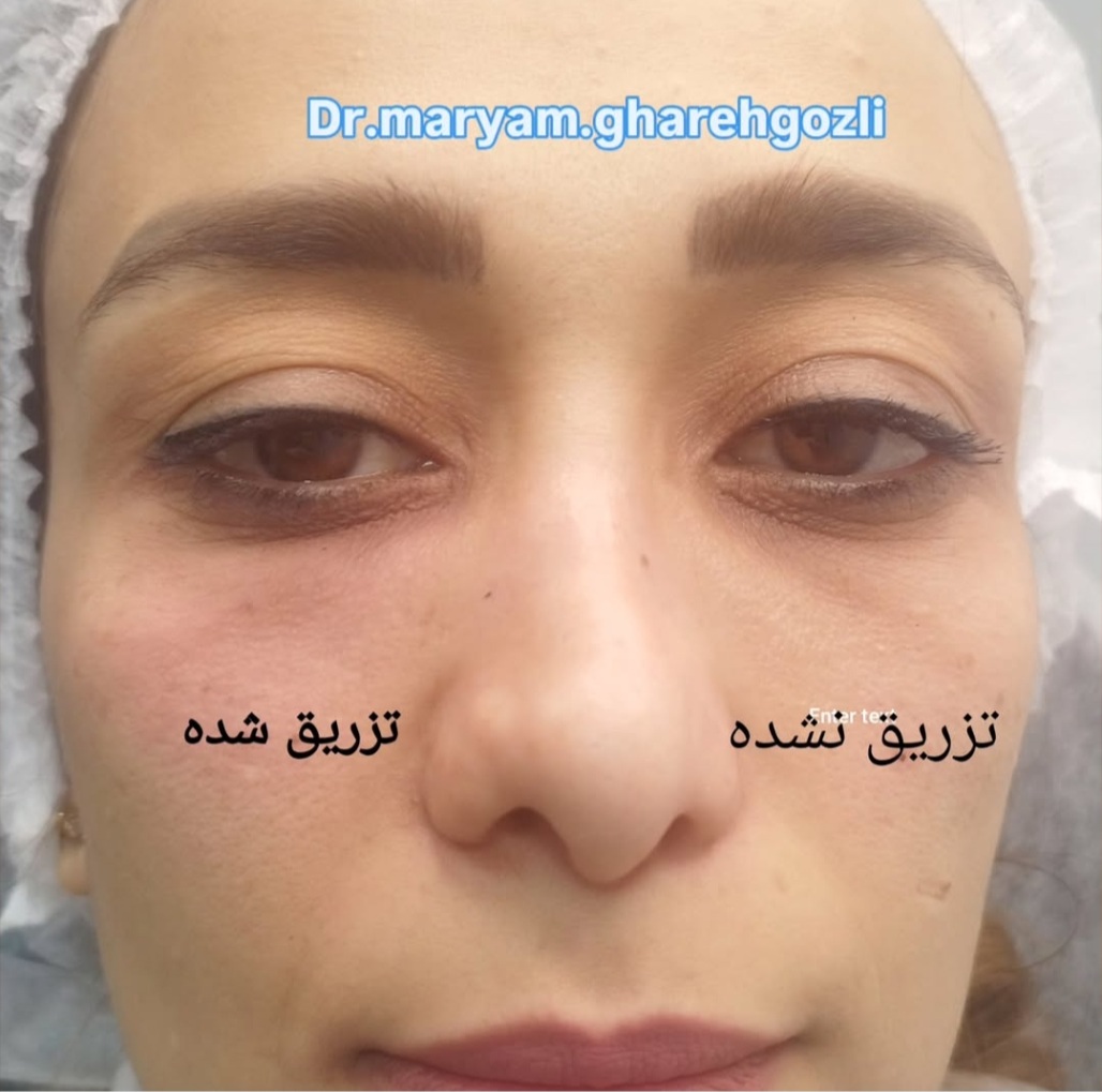 بهترین دکتر پوست و زیبایی کرمان