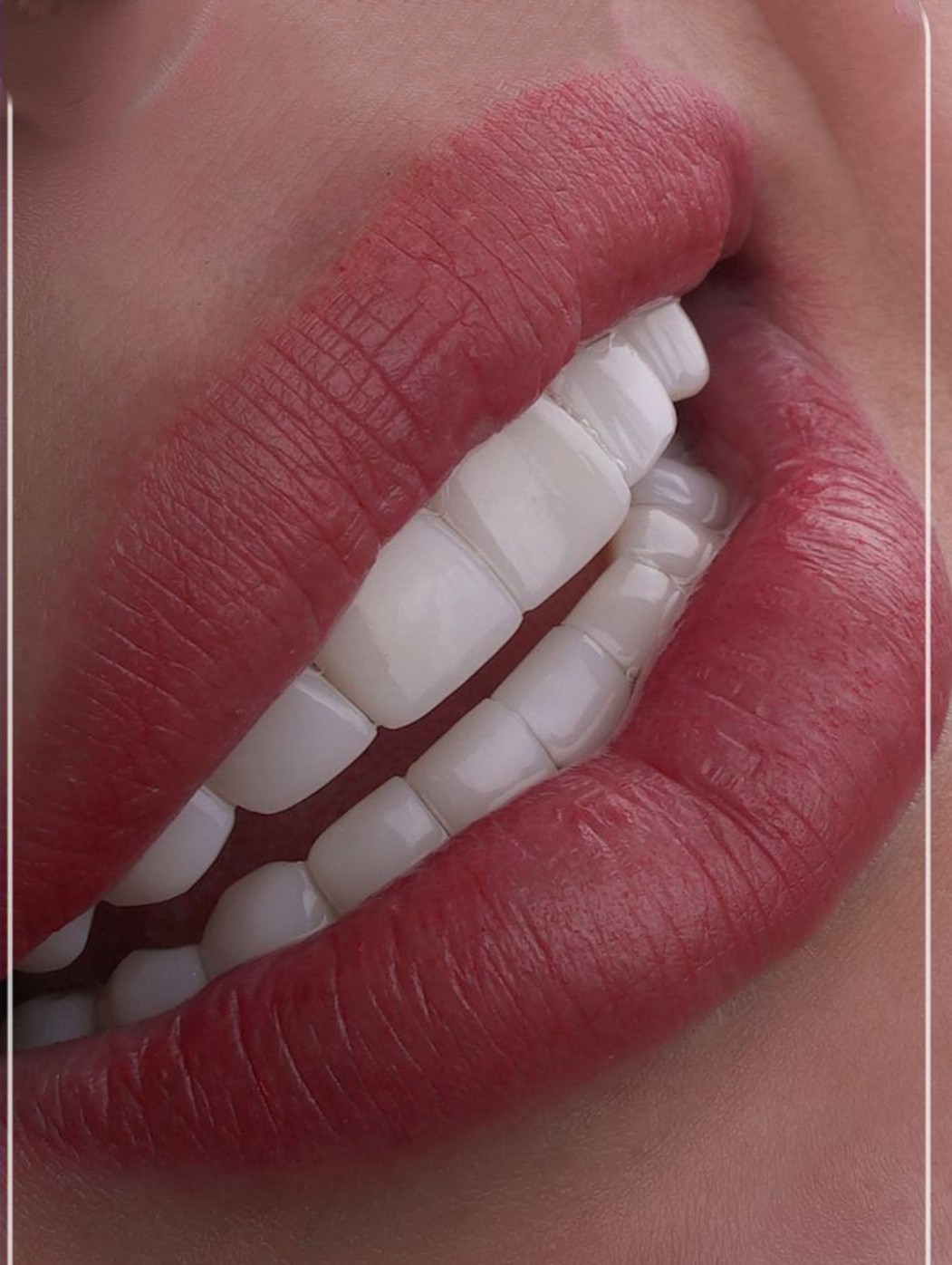 کامپوزیت دندان درشرق تهران  