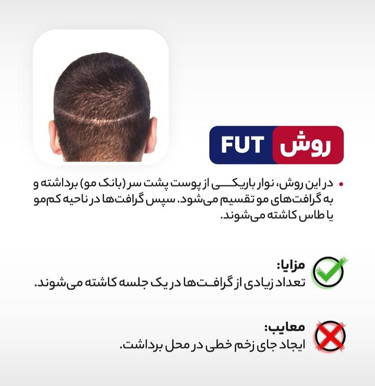 بهترین دکتر کاشت مو در ارومیه