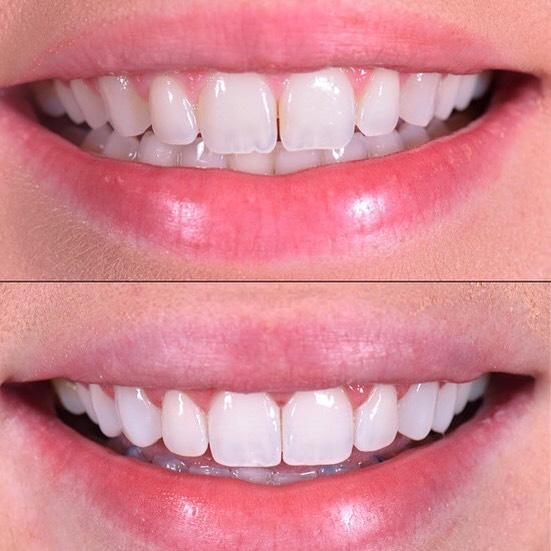 فاطمه رعیت پنبه چوله