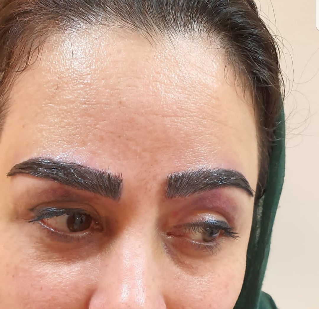 خدمات کاشت مو یزد