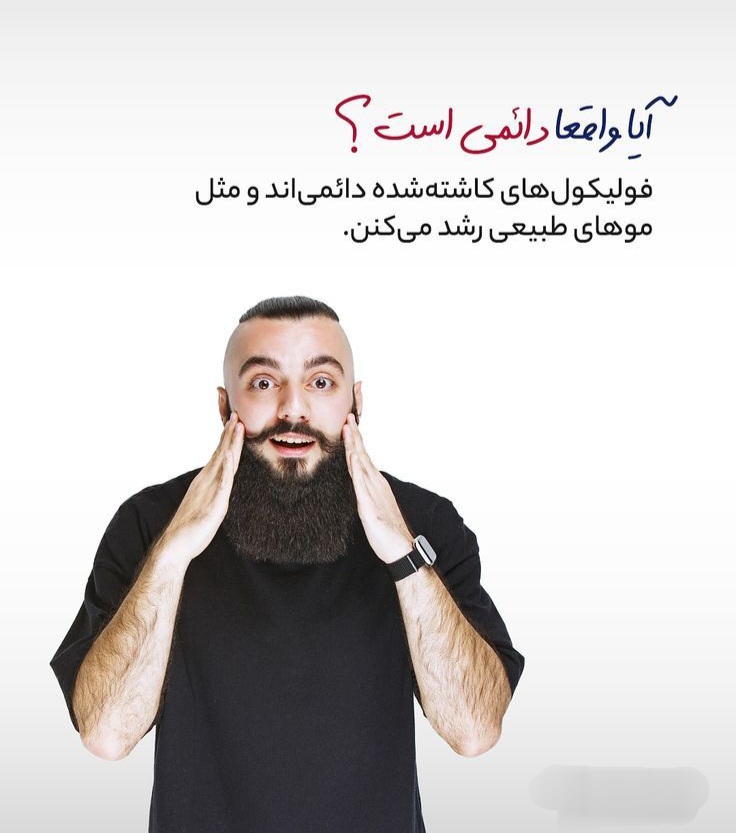 بهترین دکتر کاشت ابرو در ارومیه