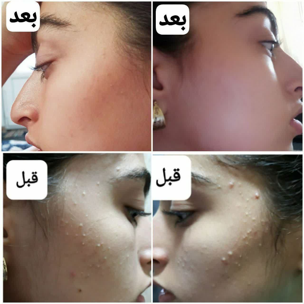بهترین مشاوره پوست مودرایران