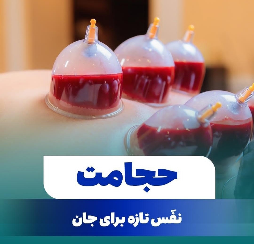 حجامت امبدینگ طب سوزنی در اصفهان