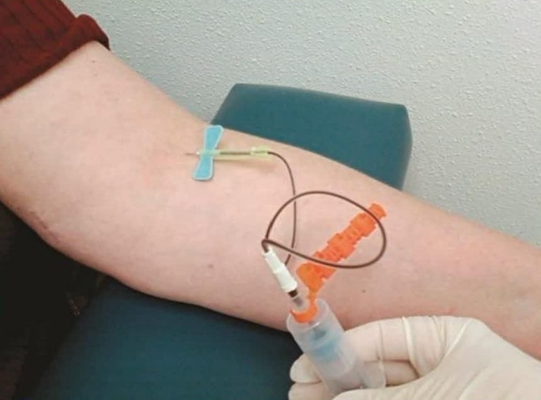 حجامت امبدینگ طب سوزنی در اصفهان