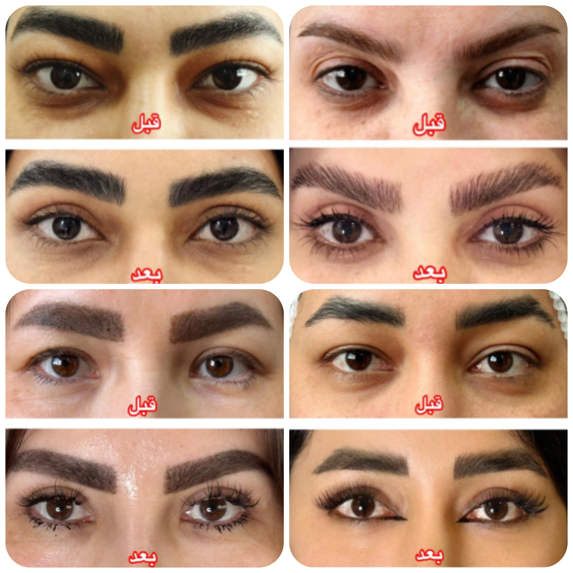 بلفاروپلاستی،لیفت صورت،کاشت مو در اصفهان 