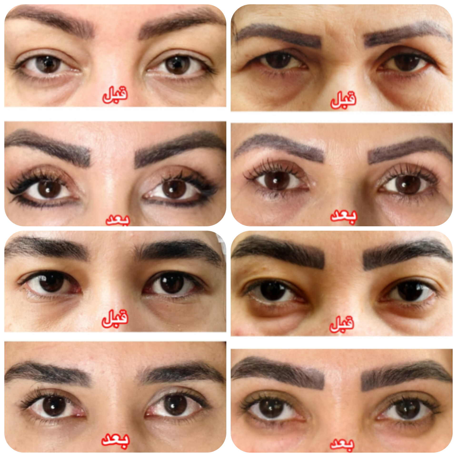 بلفاروپلاستی،لیفت صورت،کاشت مو در اصفهان 