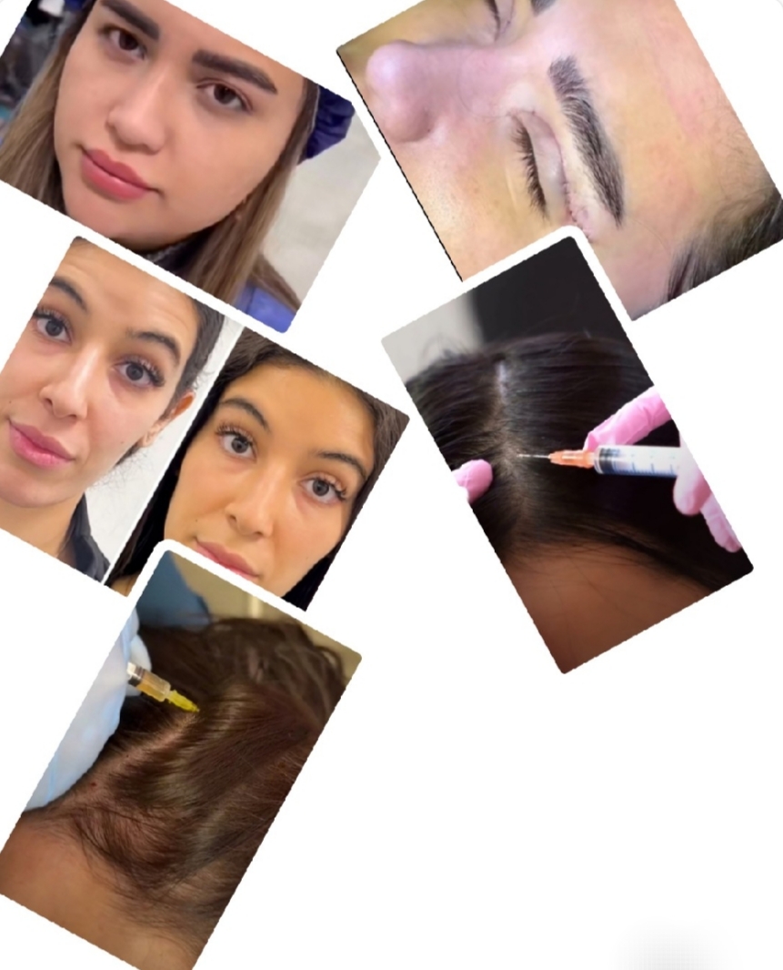 بلفاروپلاستی،لیفت صورت،کاشت مو در اصفهان 