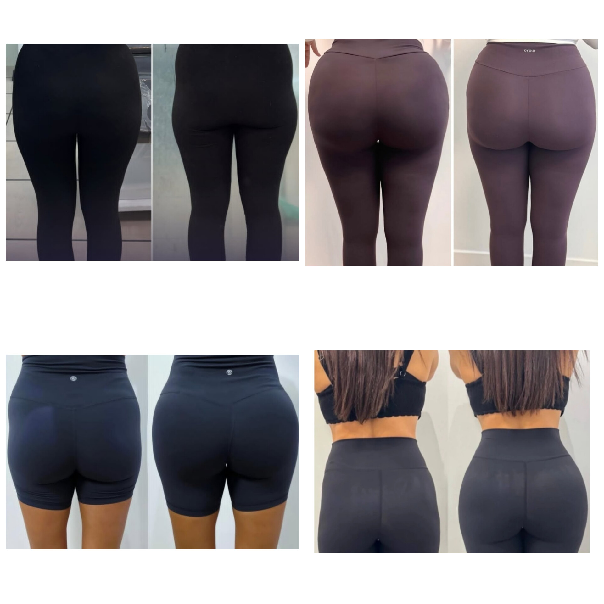 فیلر بادی بوتاکس در اصفهان 