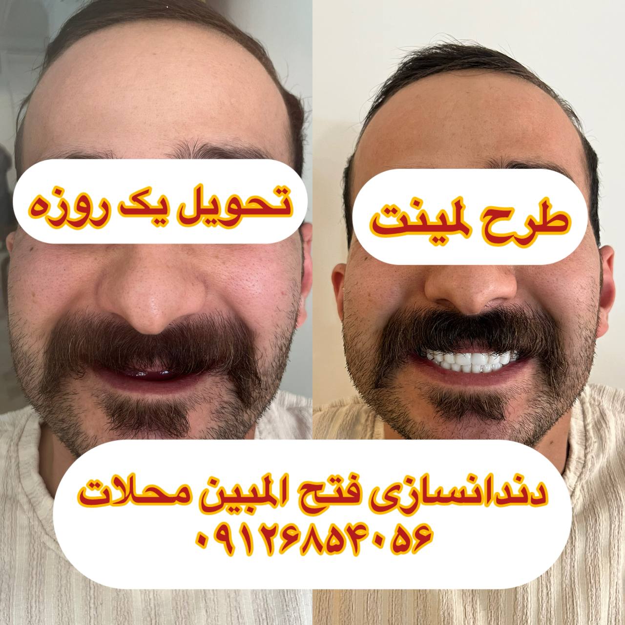 لابراتوار دندانسازی محلات
