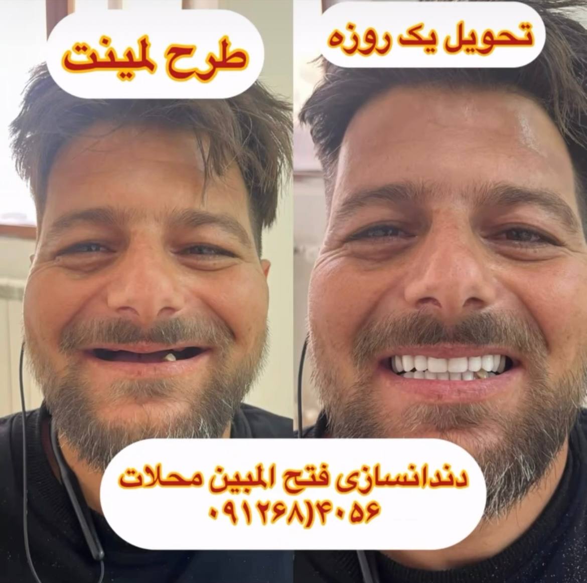 شماره تلفن دندانسازی محلات