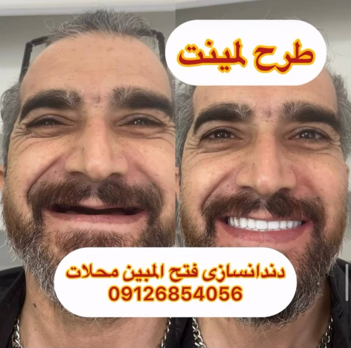 دندانساز محلات
