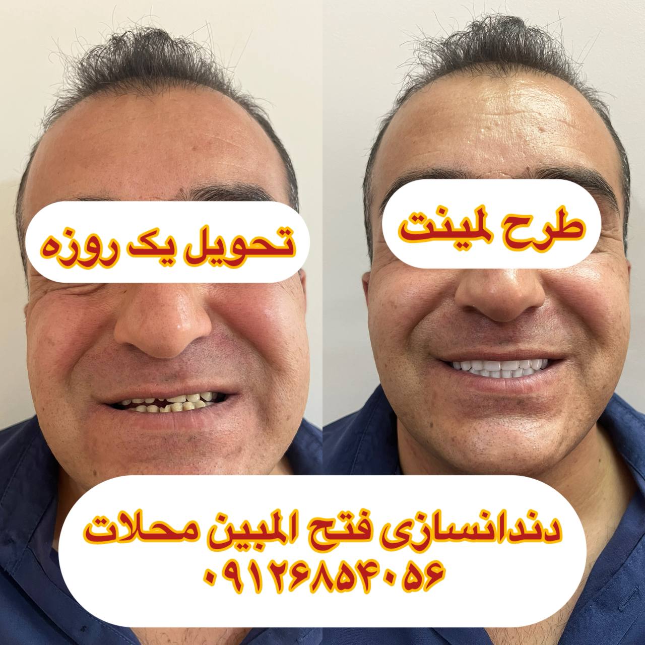 دندانسازی های محلات