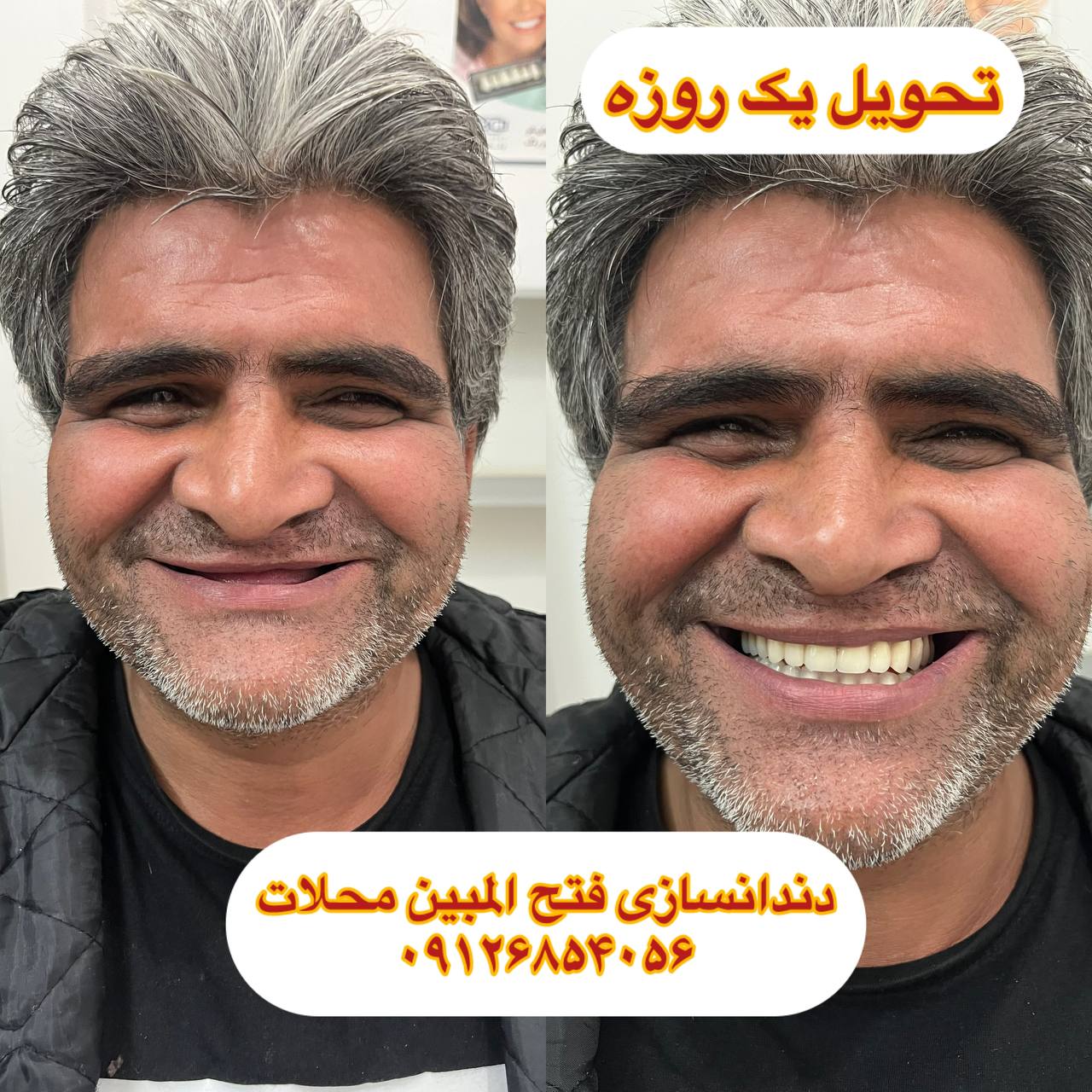 دندانسازی در محلات