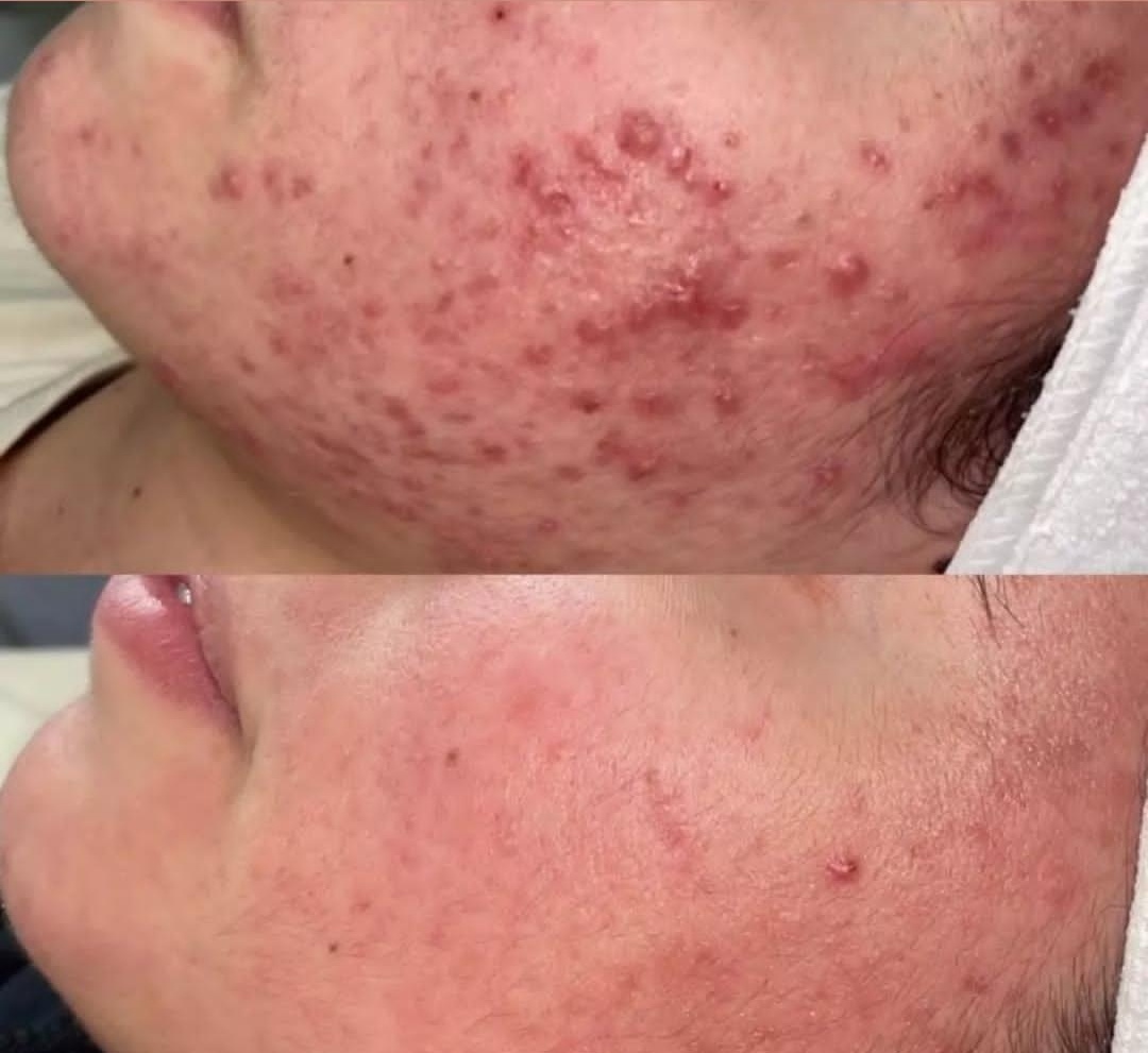 فشیال تخصصی در اصفهان 