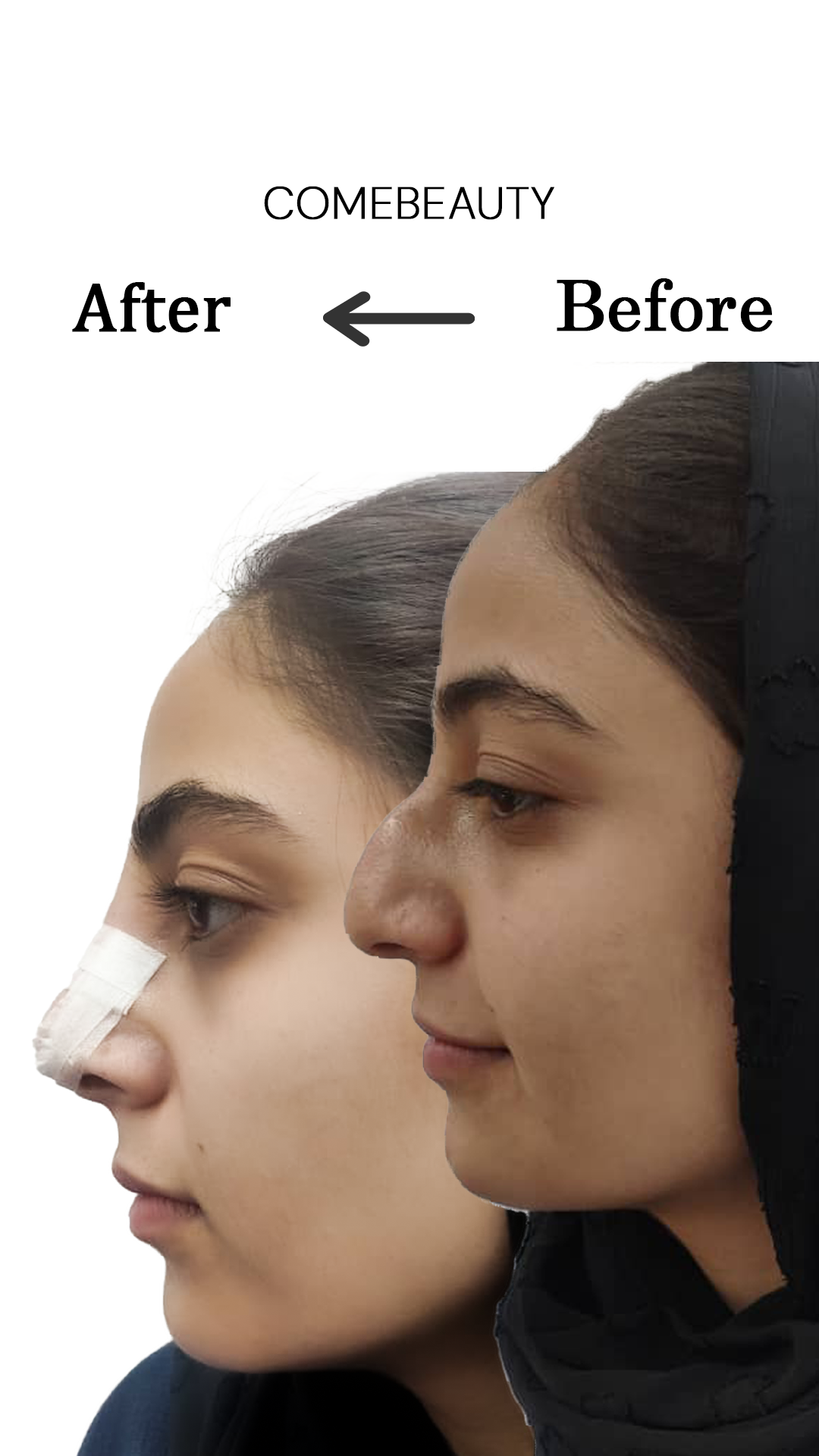 فرم دهی بینی در اصفهان